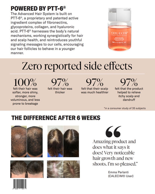 Calecim Advanced Hair Growth System – 6 Week Scalp Treatment